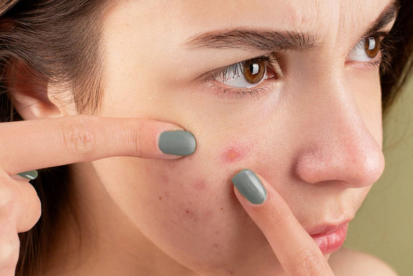 close up of woman touching blemish on her face