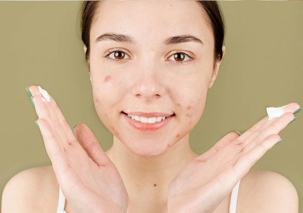 Discover The Best Sunscreen For Oily Skin