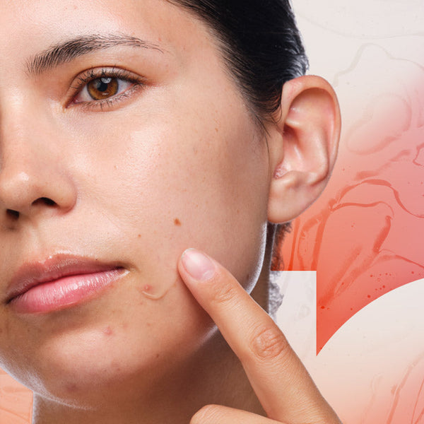 Acne Supplements