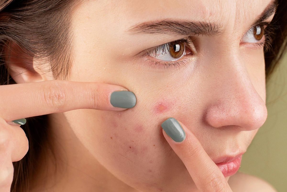 close up of woman touching blemish on her face
