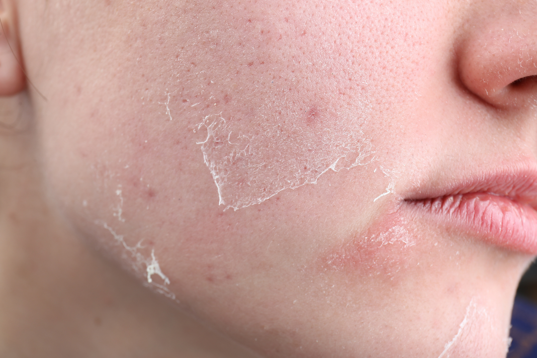 best supplements for dry skin