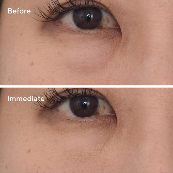 Murad Targeted Eye Depuffer