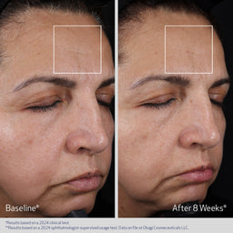 Obagi Elastiderm Advanced Filler Concentrate