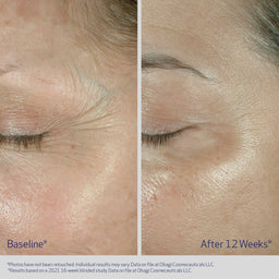 Obagi Elastiderm Eye Cream