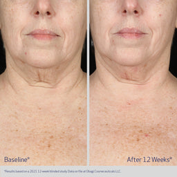 Obagi Elastiderm Neck and Decollete Concentrate