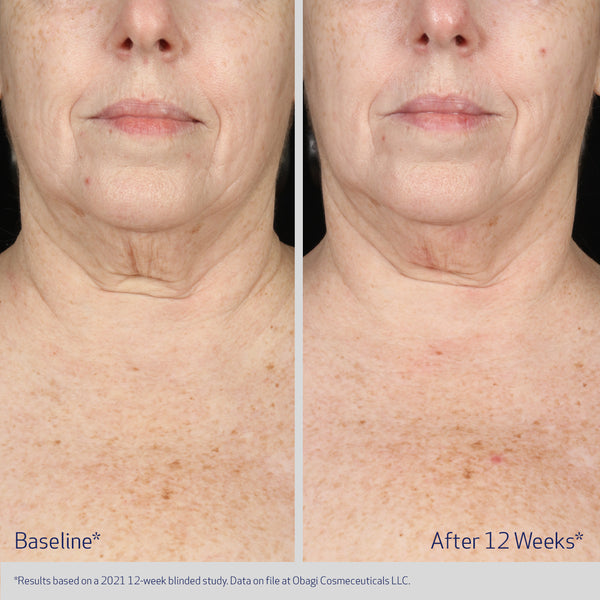 Obagi Elastiderm Neck and Decollete Concentrate