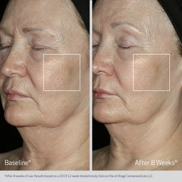 Obagi Elastiderm Facial Serum