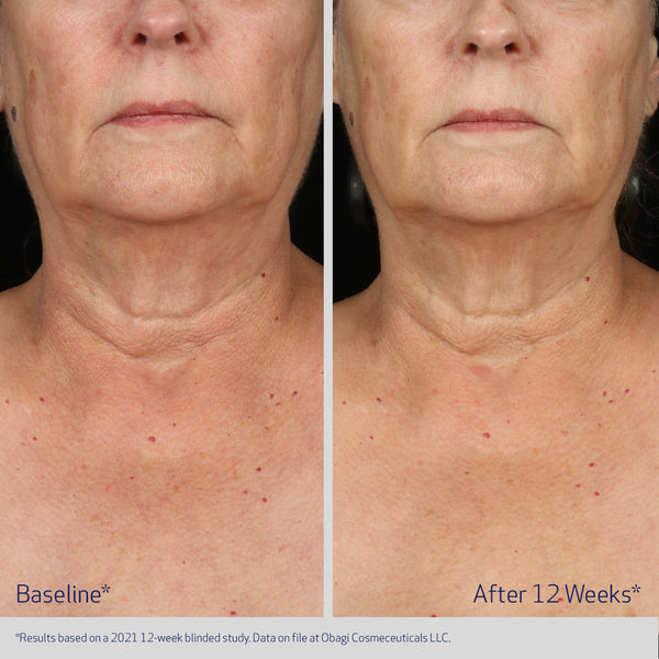 Obagi Elastiderm Neck and Decollete Concentrate