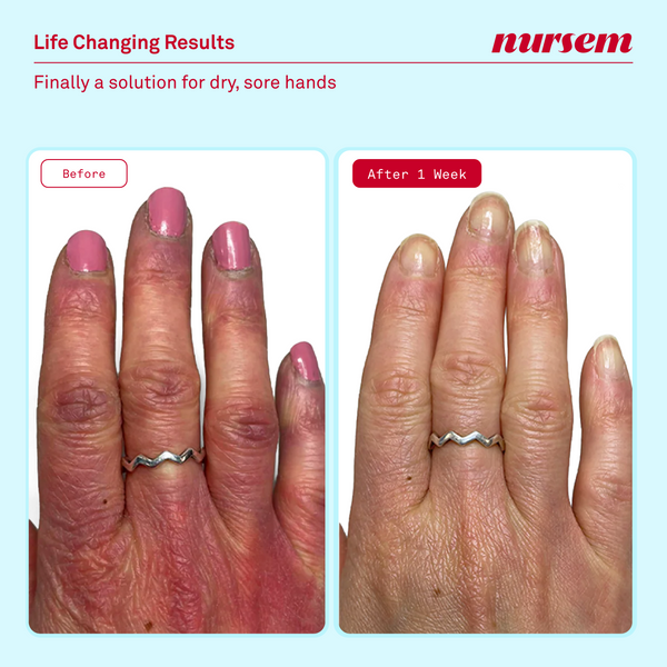Nursem Skincare Discovery Set