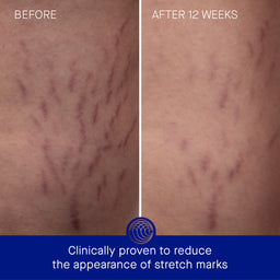 Augustinus Bader The Body Cream 200ml