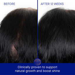 Augustinus Bader The Scalp Treatment