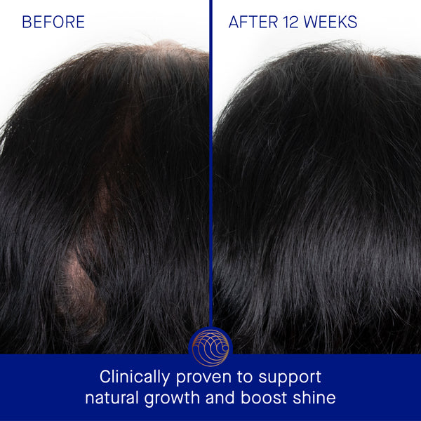 Augustinus Bader The Scalp Treatment