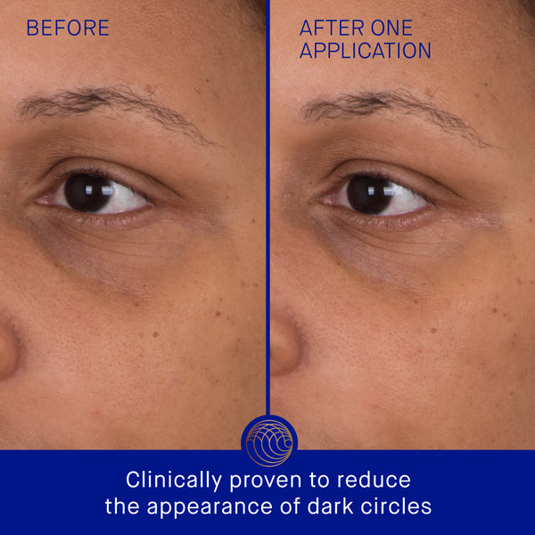 Augustinus Bader The Eye Patches