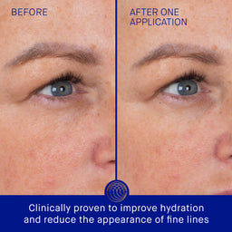 Augustinus Bader The Eye Patches