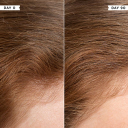 Philip Kingsley Density Scalp Drops