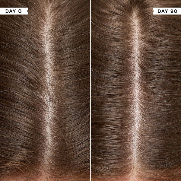 Philip Kingsley Density Scalp Drops