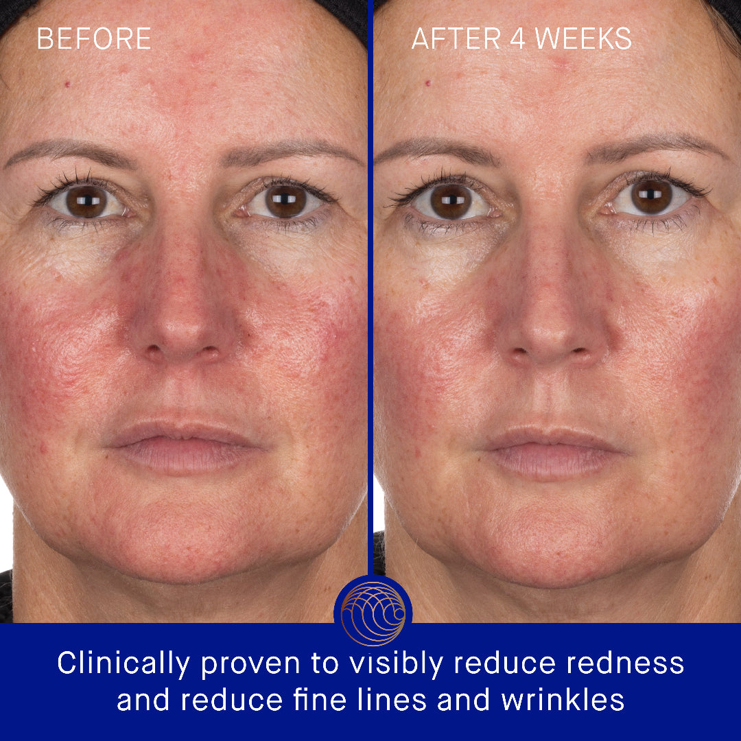 Before and after comparison of a woman's face with visible改善效果