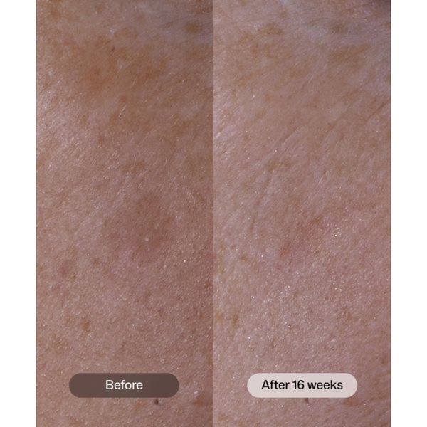 Revision Skincare Advanced Pigment Corrector+ 30g