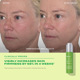 Murad Retinol Youth Renewal Oil Drops