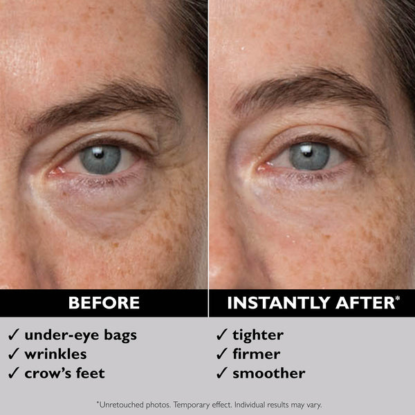 Peter Thomas Roth FIRMx Eye Duo Set