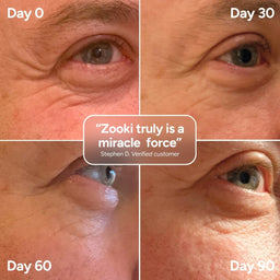 Four-panel before-and-after comparison grid showing a person's eye area over time, labeled Day 0, Day 30, Day 60, and Day 90, with a central quote bubble reading 'Zooki truly is a miracle force' and a customer name below.