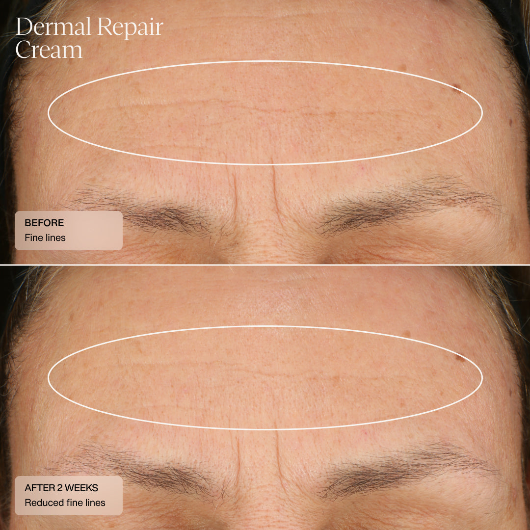Senté Dermal Repair Kit