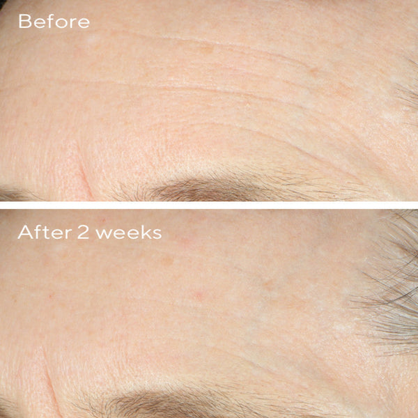 Murad Intense Recovery Cream