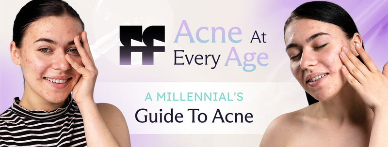 millennial acne