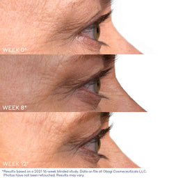 Obagi Nu-Cil Eyelash Enhancing Serum