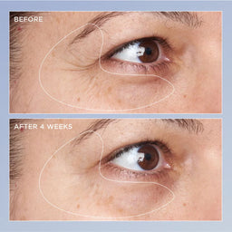 Perricone MD High Potency Triple Retinol Renewal Eye Serum 15ml