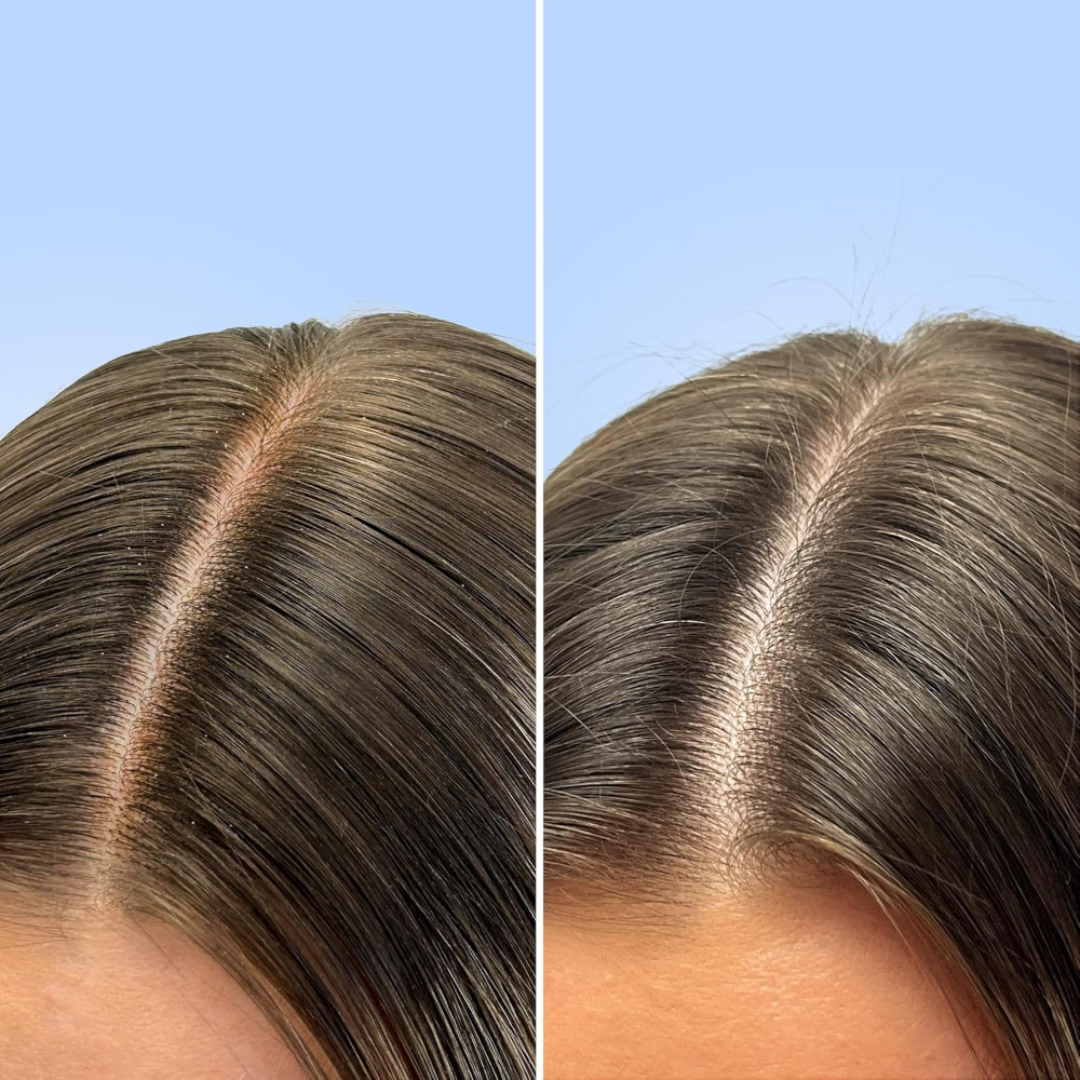 Side-by-side comparison of hair with and without gray hair strands on a blue background