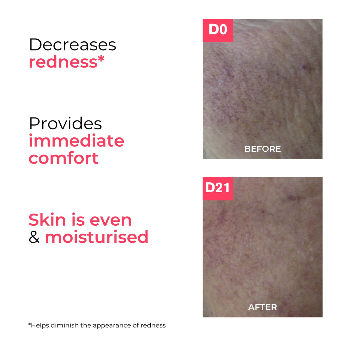 Uriage Roseliane Visible Redness-Neutralizing Care 40ml