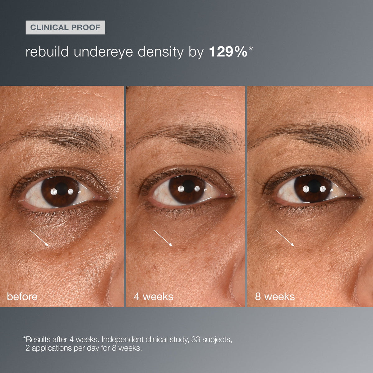 Dermalogica Smart Eye Density Serum 15ml