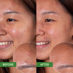 Sand & Sky Clearing Face Mask 100ml