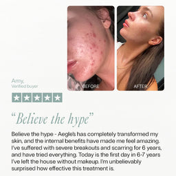 Before and after comparison of a person's skin with text and rating on a white background