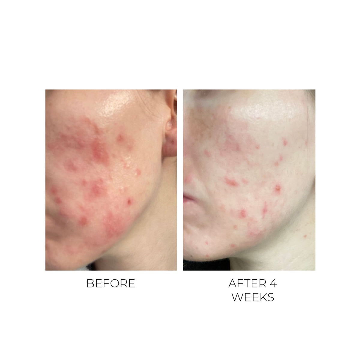 OSKIA Violet Water Toner