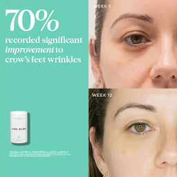 Vida Glow Natural Marine Collagen Caddy