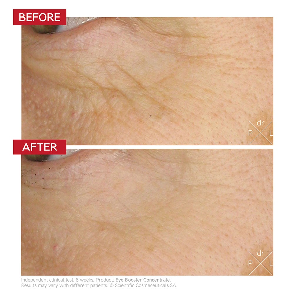 Before and after using the product