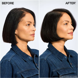 Redken Acidic Grow Full System Densifying Conditioner for Thin Hair, Strengthens & Thickens 300ml